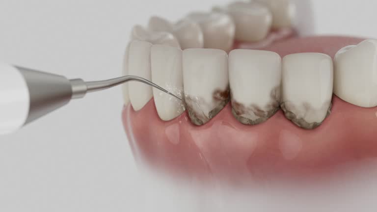 Reliable Root Canal Treatment contractor in Baxter County County, AR by Dentist Open Now